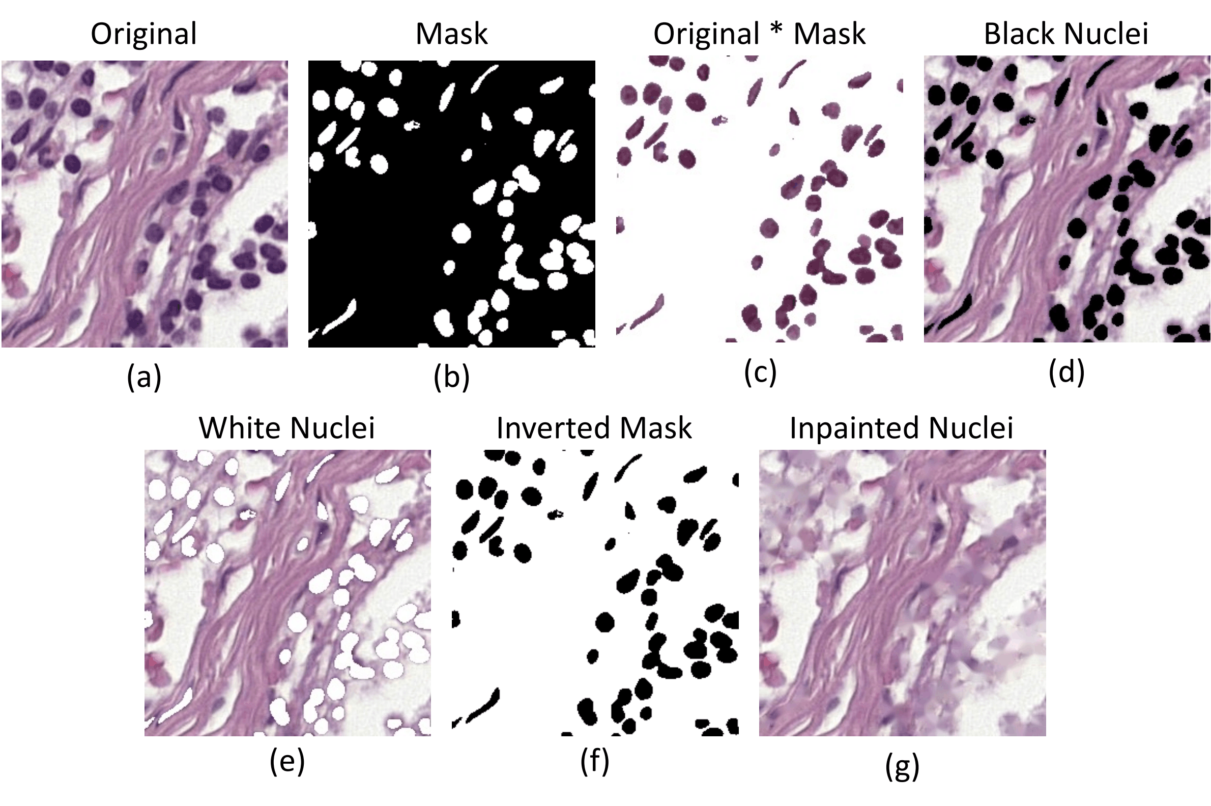 An H&E tile, its nuclear mask, the image multiplied by the mask, nuclei filled with black or white, an inverted mask, and an image with nuclei inpainted away.