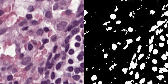 An H&E-stained histopathology tile beside its binary nuclear segmentation mask.