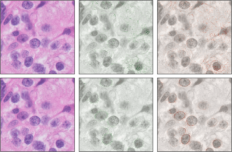 Matched Integrated Gradients examples comparing an ordinary augmented model with the proposed nuclear-guided model.